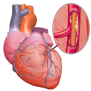 colestrol